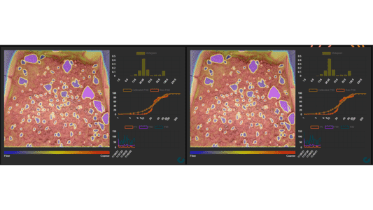 Caracterización de procesos: Molienda